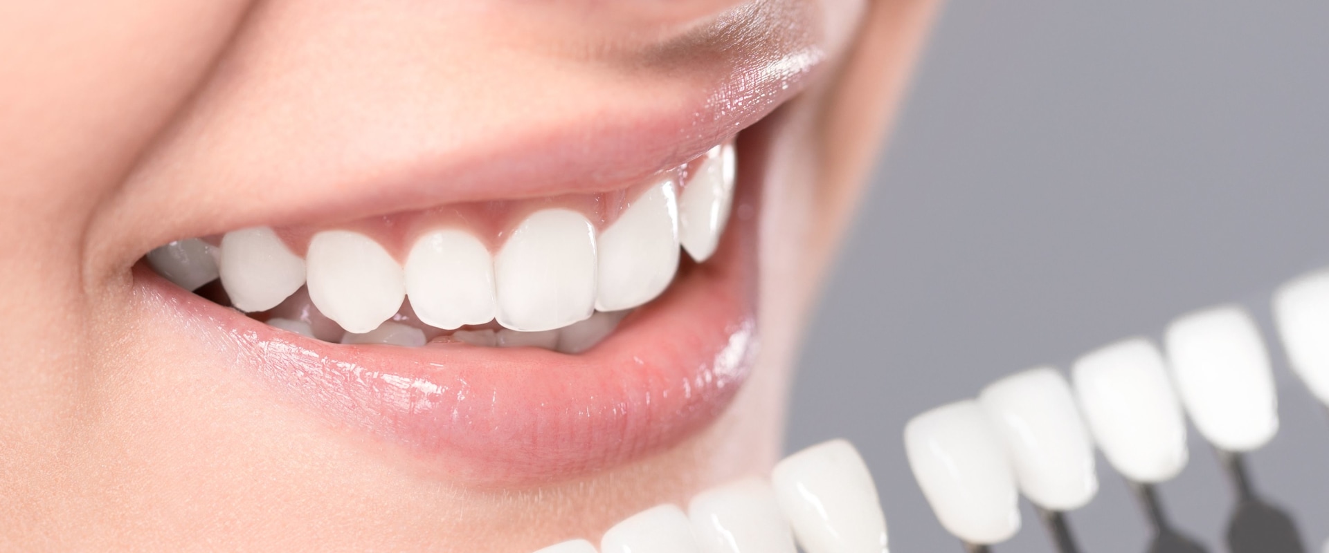 Kor Whitening Reviews: An In-Depth Look at Teeth Whitening Treatments