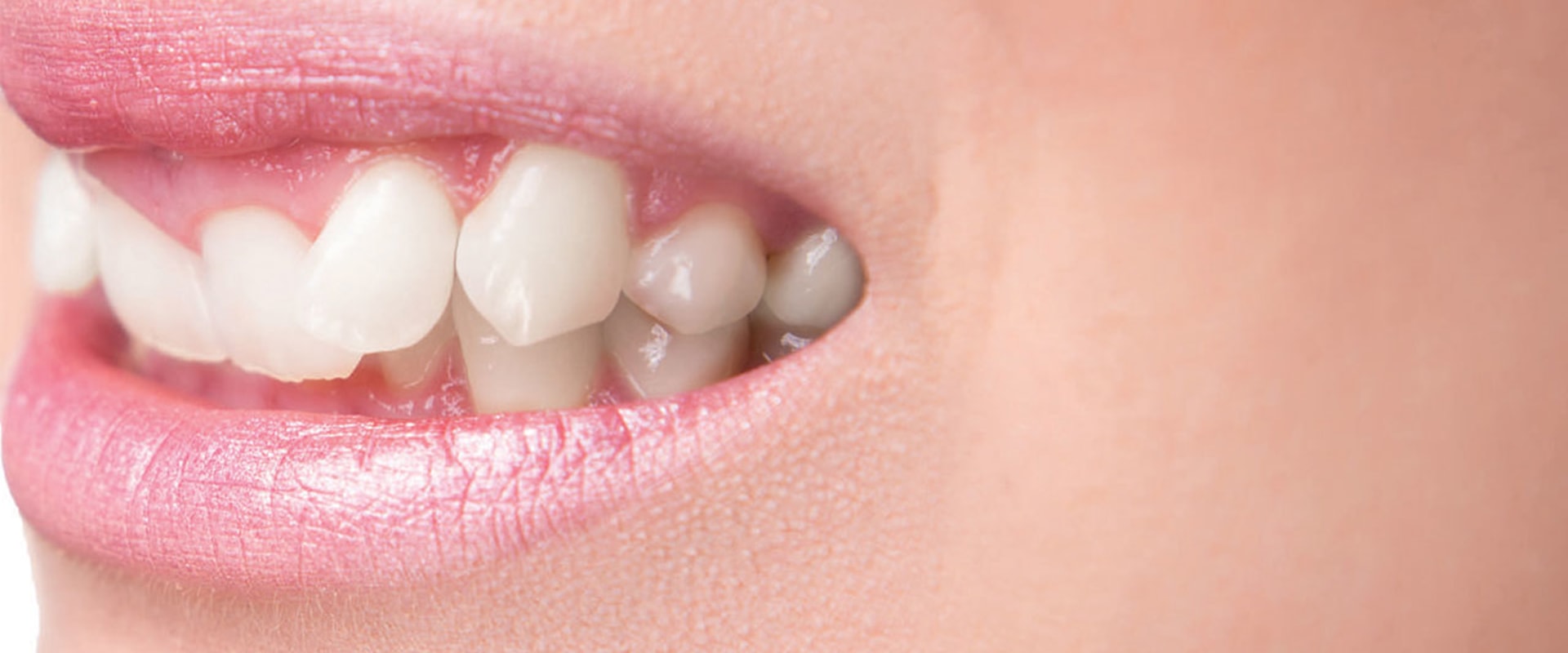 Understanding Enamel Reshaping Cost Breakdowns