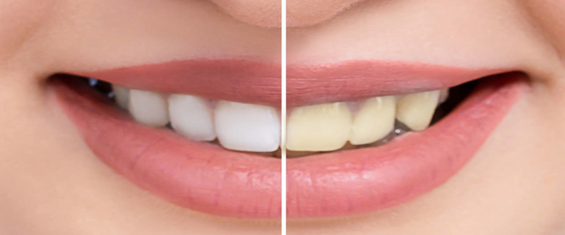 Eating Habits for Whiter Teeth