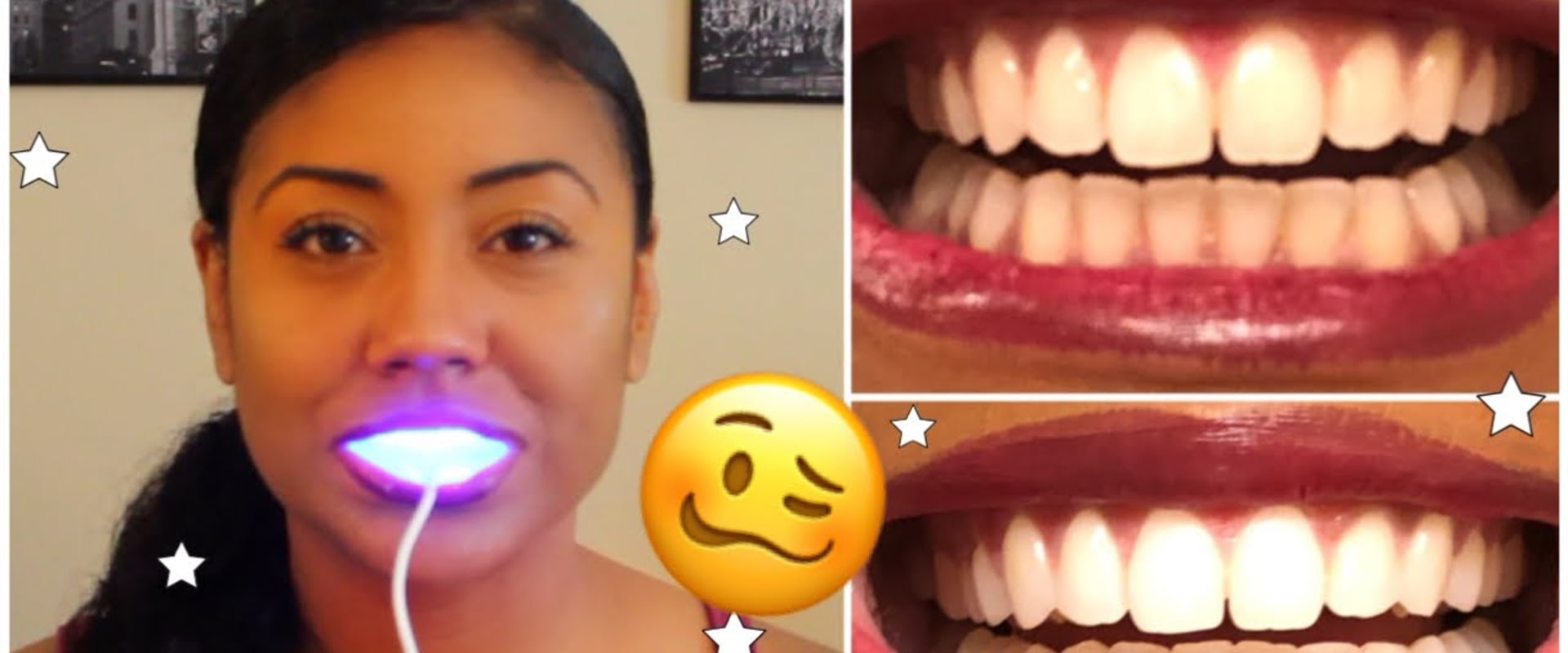 Review of Strips and Gels for Teeth Whitening