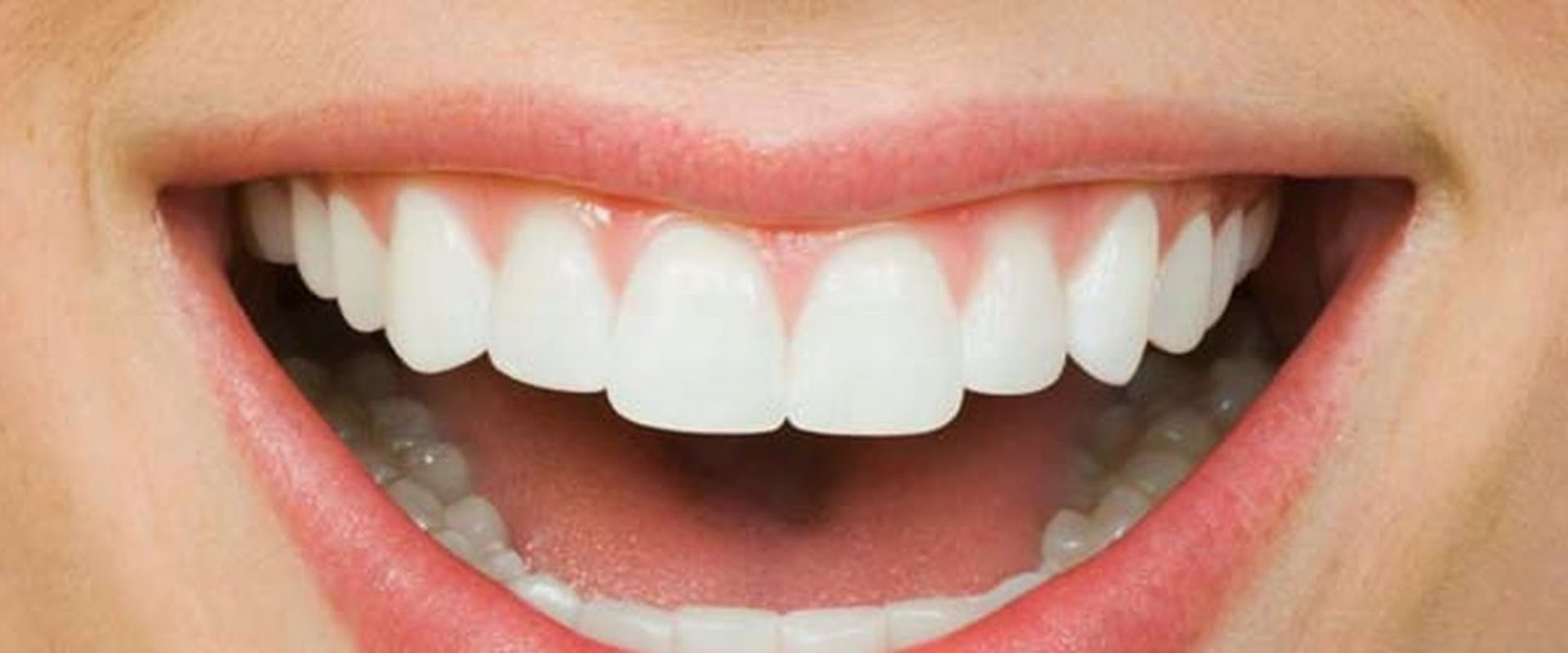 Drinks to Avoid for Whiter Teeth