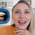 Reviews of In-Office Teeth Whitening Treatments