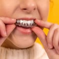 The Science Behind Whitening Gels and Trays