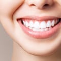 What is Titanium Dioxide and How Does it Impact Teeth Whitening Products?
