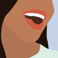 Cost of Whitening Strips: A Comprehensive Overview