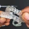 Tips for Whitening Gels and Trays