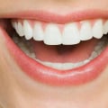 Drinks to Avoid for Whiter Teeth