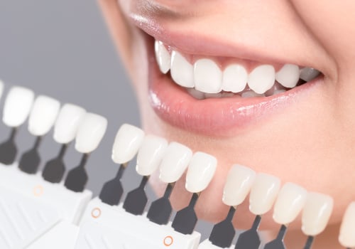 Kor Whitening Reviews: An In-Depth Look at Teeth Whitening Treatments
