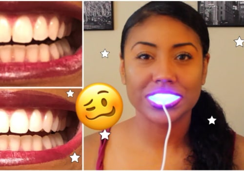How to Get the Best Results from At-Home Teeth Whitening Kits