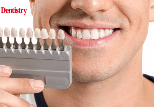 Hydrogen Peroxide: What You Need to Know About Teeth Whitening Products
