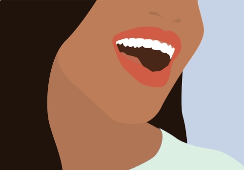 Cost of Whitening Strips: A Comprehensive Overview