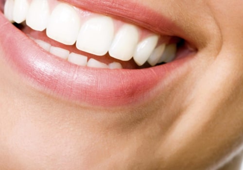 A Comprehensive Overview of AuraGlow: A Leading Teeth Whitening Brand