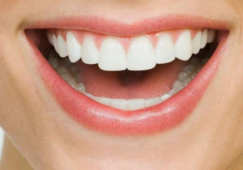 Drinks to Avoid for Whiter Teeth