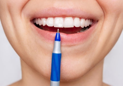 Cost of Whitening Pens: Everything You Need to Know